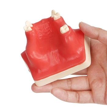 Обучающая модель зубного имплантата Модель верхней челюсти Верхнечелюстной пазухи Модель зубов для практики студентов-стоматологов